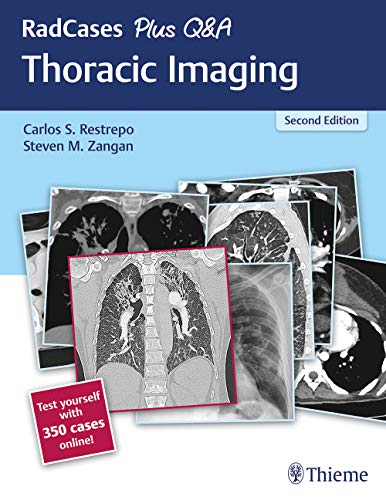 RadCases Plus Q&A Thoracic Imaging, 2nd Edition