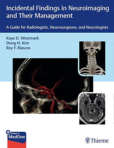 Incidental Findings in Neuroimaging and Their Management: A Guide for Radiologists, Neurosurgeons, and Neurologists