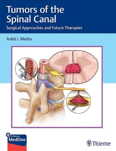 Tumors of the Spinal Canal: Surgical Approaches and Future Therapies