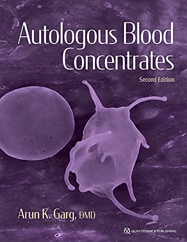 Autulogous Blood Concentrates, 2nd Edition