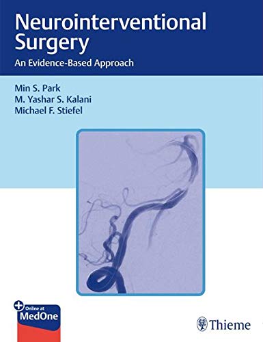Neurointerventional Surgery: An Evidence-based Approach