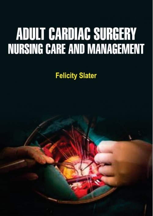 Adult Cardiac Surgery Nursing Care and Management