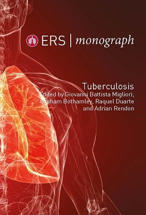 ERS Monograph 82 (Tuberculosis)