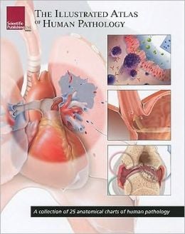 The Illustrated Atlas of Human Pathology