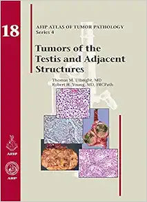 Tumors of the Testis and Adjacent Structures (AFIP Atlas of Tumor Pathology, Series 4, Fascicle 18)