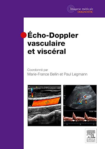 Echo-doppler Vasculaire Et Viscéral (French Edition)