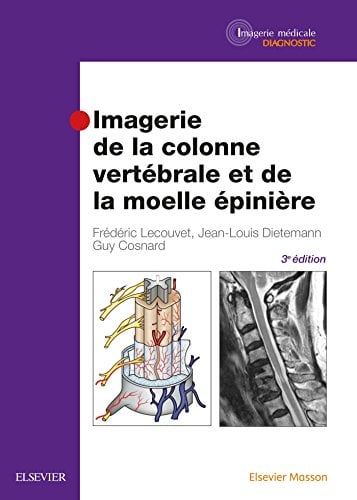 Imagerie De La Colonne Vertébrale Et De La Moelle Épinière (French Edition), 3rd Edition (PDF)