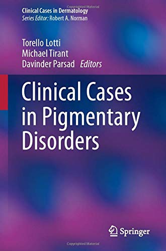 Clinical Cases in Pigmentary Disorders