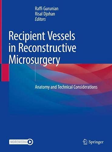 Recipient Vessels in Reconstructive Microsurgery: Anatomy and Technical Considerations