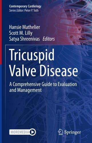 Tricuspid Valve Disease: A Comprehensive Guide to Evaluation and Management (Contemporary Cardiology)