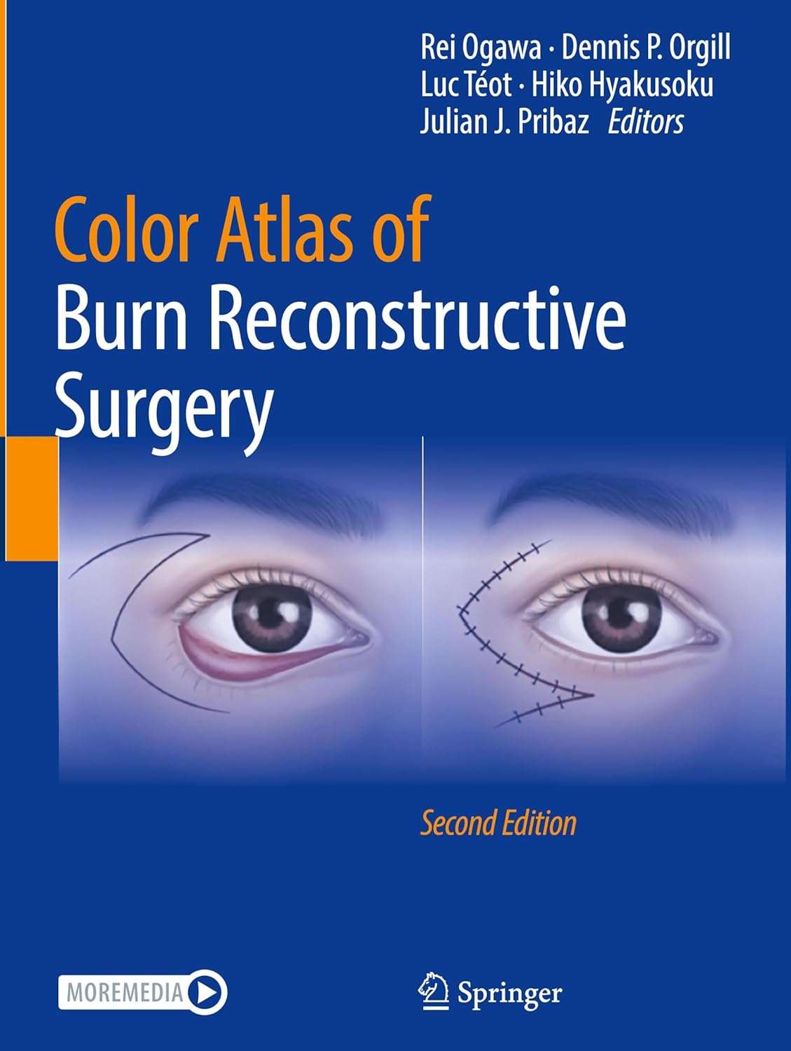 Color Atlas of Burn Reconstructive Surgery, 2025th Edition