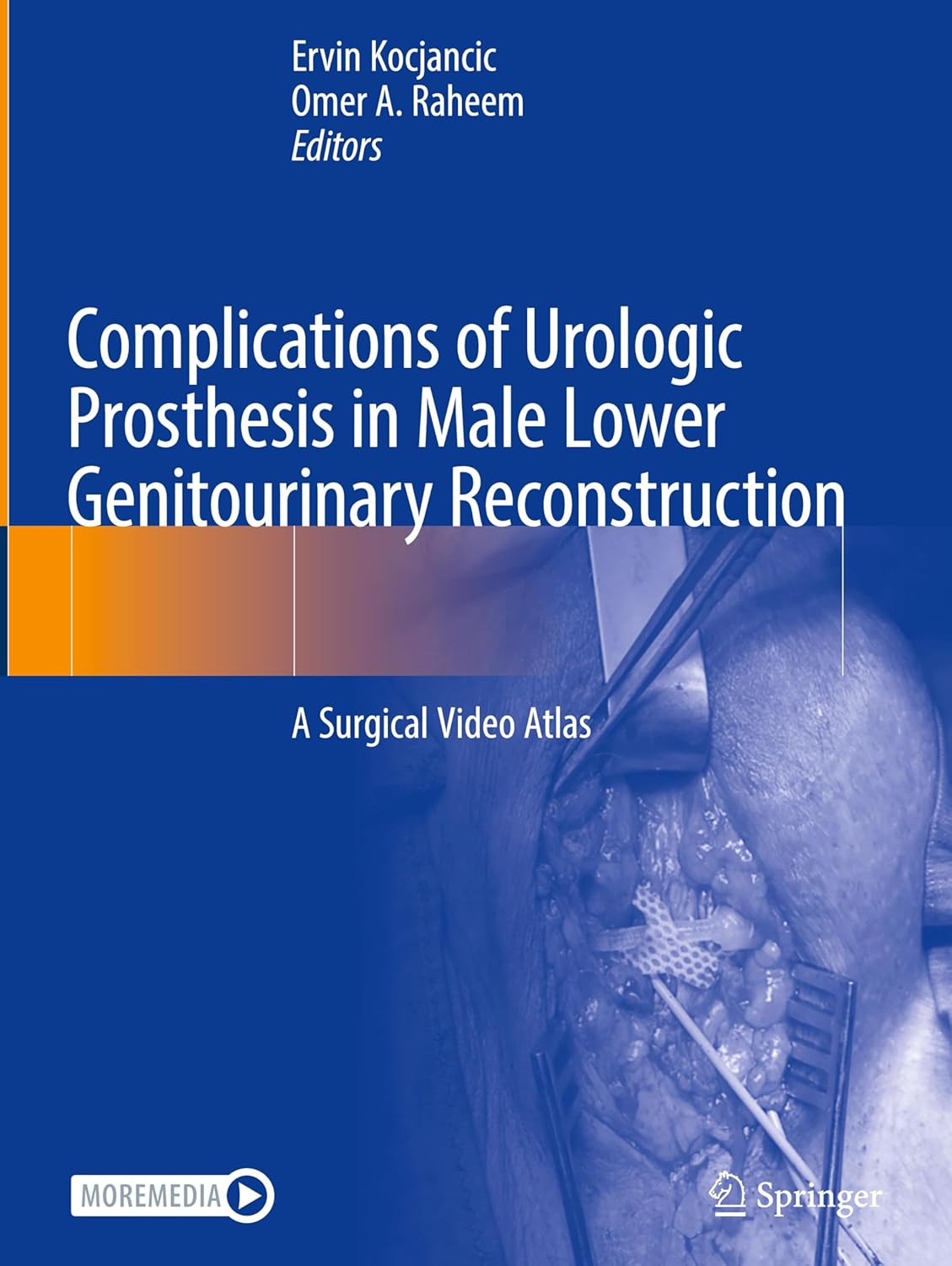 Complications of Urologic Prosthesis in Male Lower Genitourinary Reconstruction: A Surgical Video Atlas