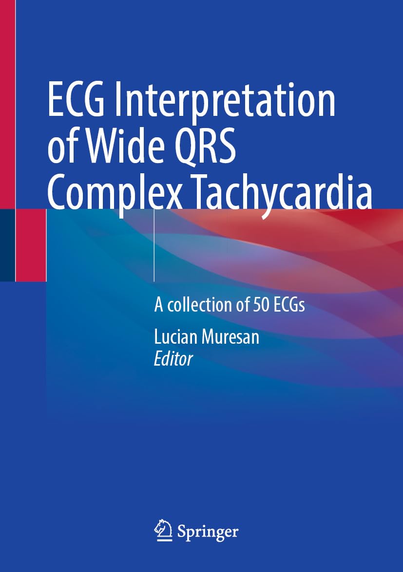 ECG Interpretation of Wide QRS Complex Tachycardia: A collection of 50 ECGs