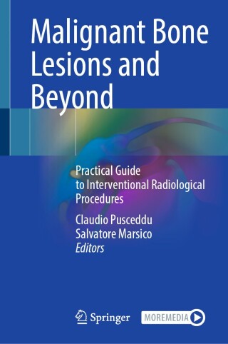 Malignant Bone Lesions and Beyond