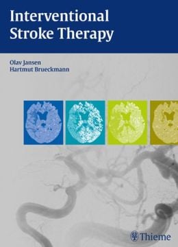 Interventional Stroke Therapy (ORIGINAL PDF from Publisher)