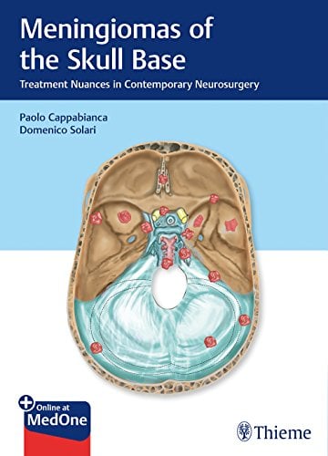 Meningiomas of the Skull Base: Treatment Nuances in Contemporary Neurosurgery (PDF)