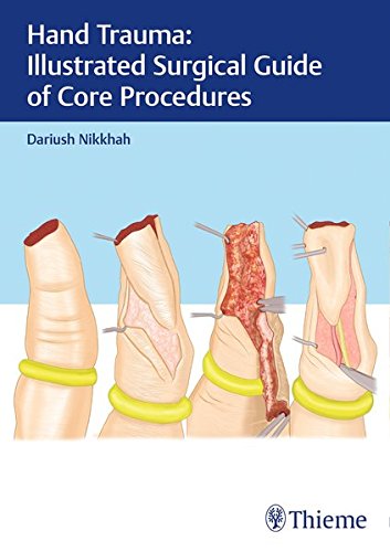 Hand Trauma: Illustrated Surgical Guide of Core Procedures (PDF)