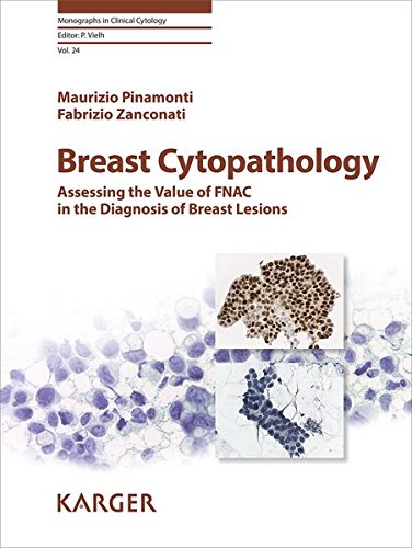 Breast Cytopathology: Assessing the Value of FNAC in the Diagnosis of Breast Lesions (Monographs in Clinical Cytology, Vol. 24) (PDF)