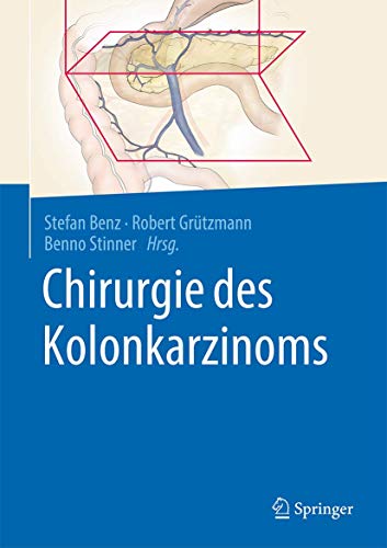 Chirurgie des Kolonkarzinoms (German Edition)