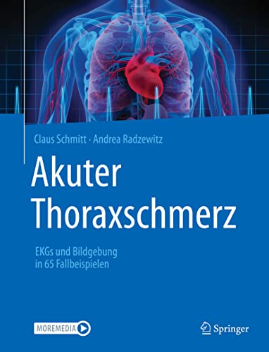 Akuter Thoraxschmerz: EKGs und Bildgebung in 65 Fallbeispielen (German Edition)