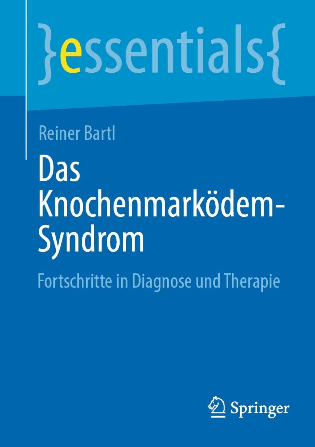 Das Knochenmarködem-Syndrom: Fortschritte in Diagnose und Therapie