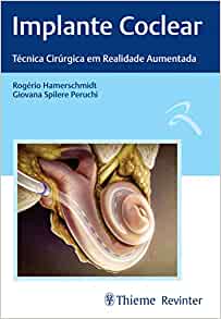 Implante Coclear: Técnicas Cirúrgica em Realidade Aumentada