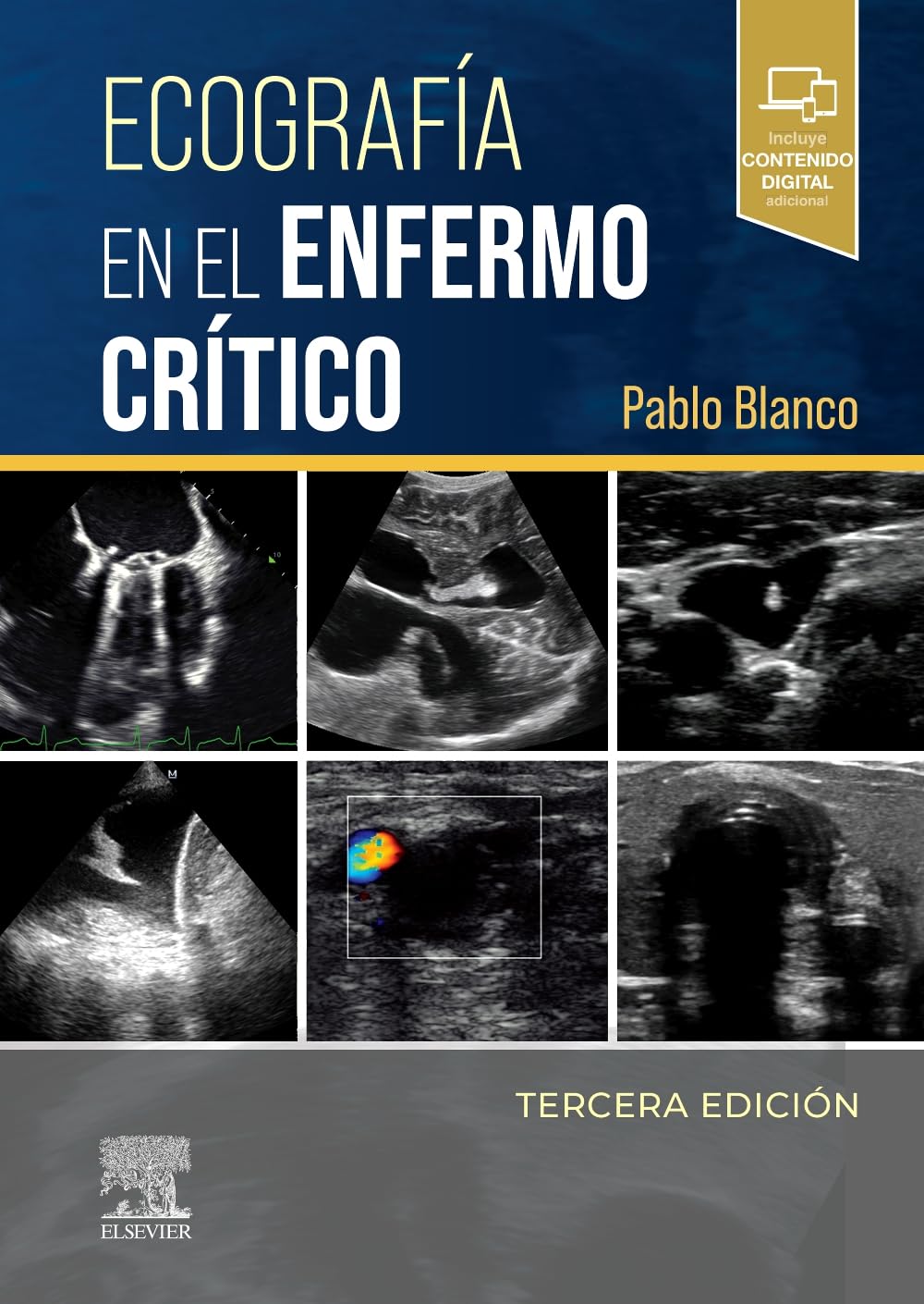 Ecografía en el enfermo crítico, 3rd Edition