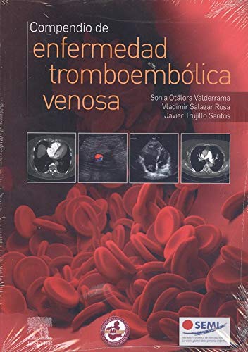 Compendio de enfermedad tromboembólica venosa (Spanish Edition)