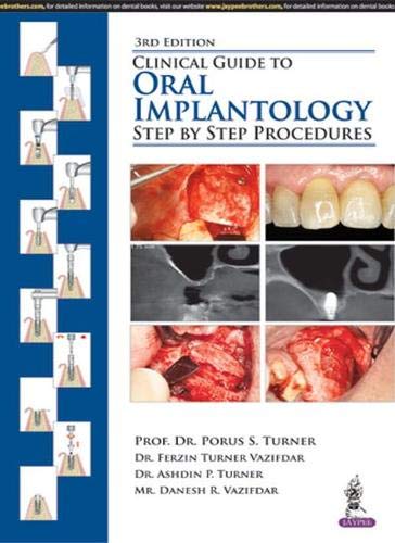 Clinical Guide to Oral Implantology: Step by Step Procedures, 3rd Edition