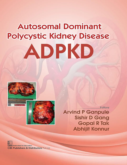 Autosomal Dominant Polytechnic Kidney Disease ADPKD