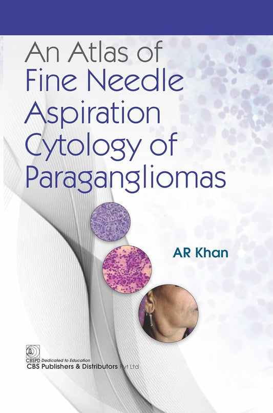 An Atlas of Fine Needle Aspiration Cytology of Paragangliomas