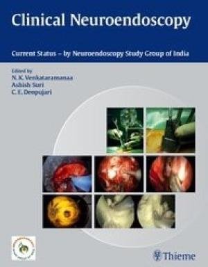Clinical Neuroendoscopy: Current Status By Neuroendoscopy Group of India