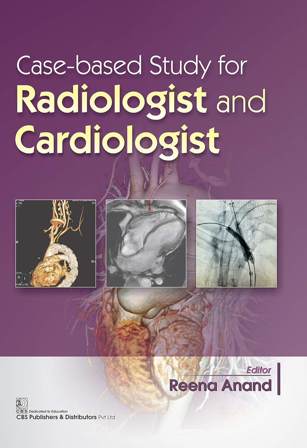 Case Based Study for Radiologist and Cardiologist