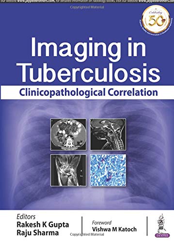 Imaging in Tuberculosis: Clinicopathological Correlation
