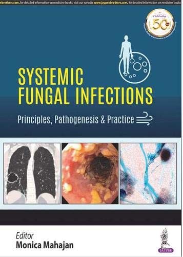 Systemic Fungal Infections: Principles, Pathogenesis & Practice