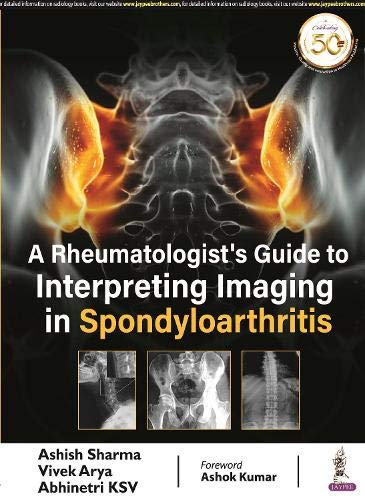 A Rheumatologist’s Guide to Interpreting Imaging in Spondyloarthritis
