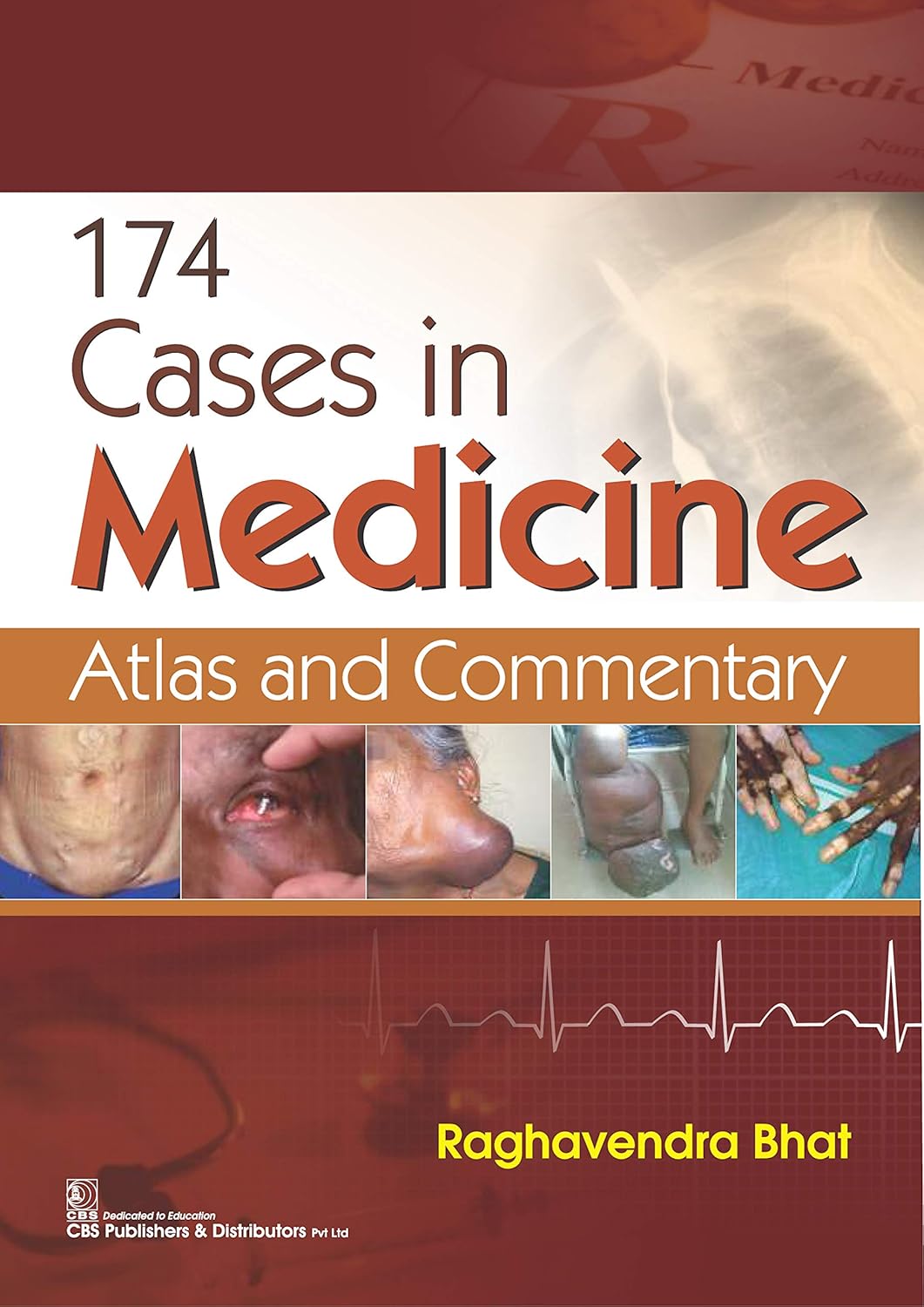 174 cases in Medicine