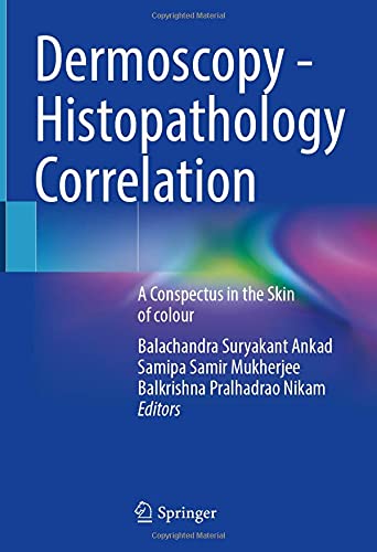 Dermoscopy – Histopathology Correlation: A Conspectus in the Skin of colour