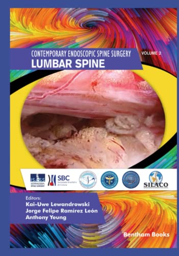 Lumbar Spine