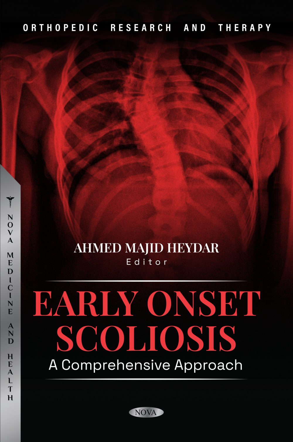 Early Onset Scoliosis: A Comprehensive Approach