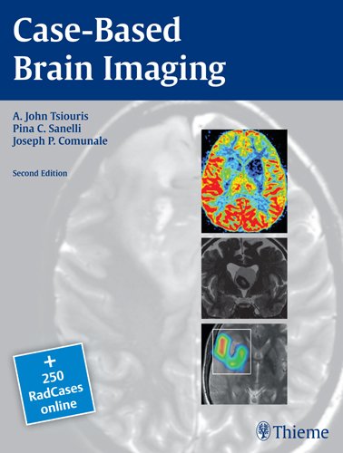 Case-Based Brain Imaging 2nd Edition