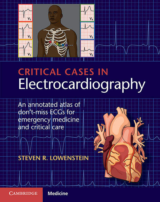 Critical Cases in Electrocardiography: An Annotated Atlas of Don’t-Miss ECGs for Emergency Medicine and Critical Care, 1e