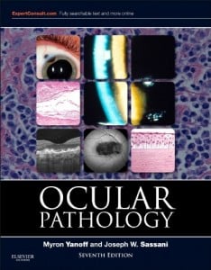 Ocular Pathology: Expert Consult – Online and Print, 7e (ORIGINAL PDF from Publisher)