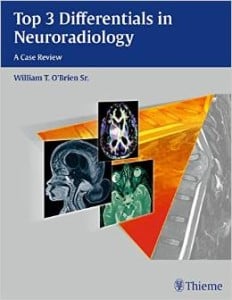 Top 3 Differentials in Neuroradiology: A Case Review (ORIGINAL PDF from Publisher)