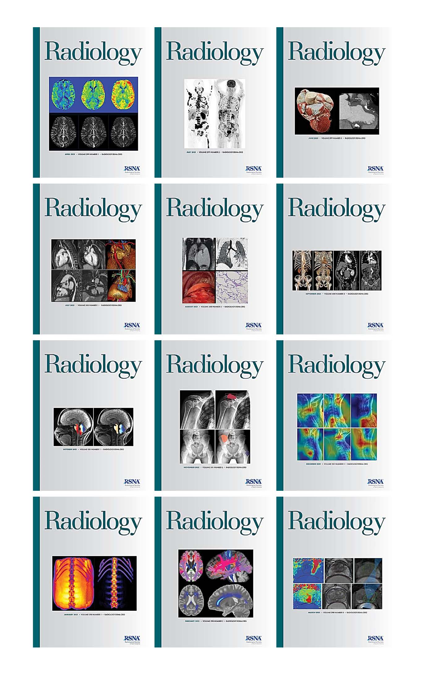 Radiology 2021 Full Archives (True PDF)