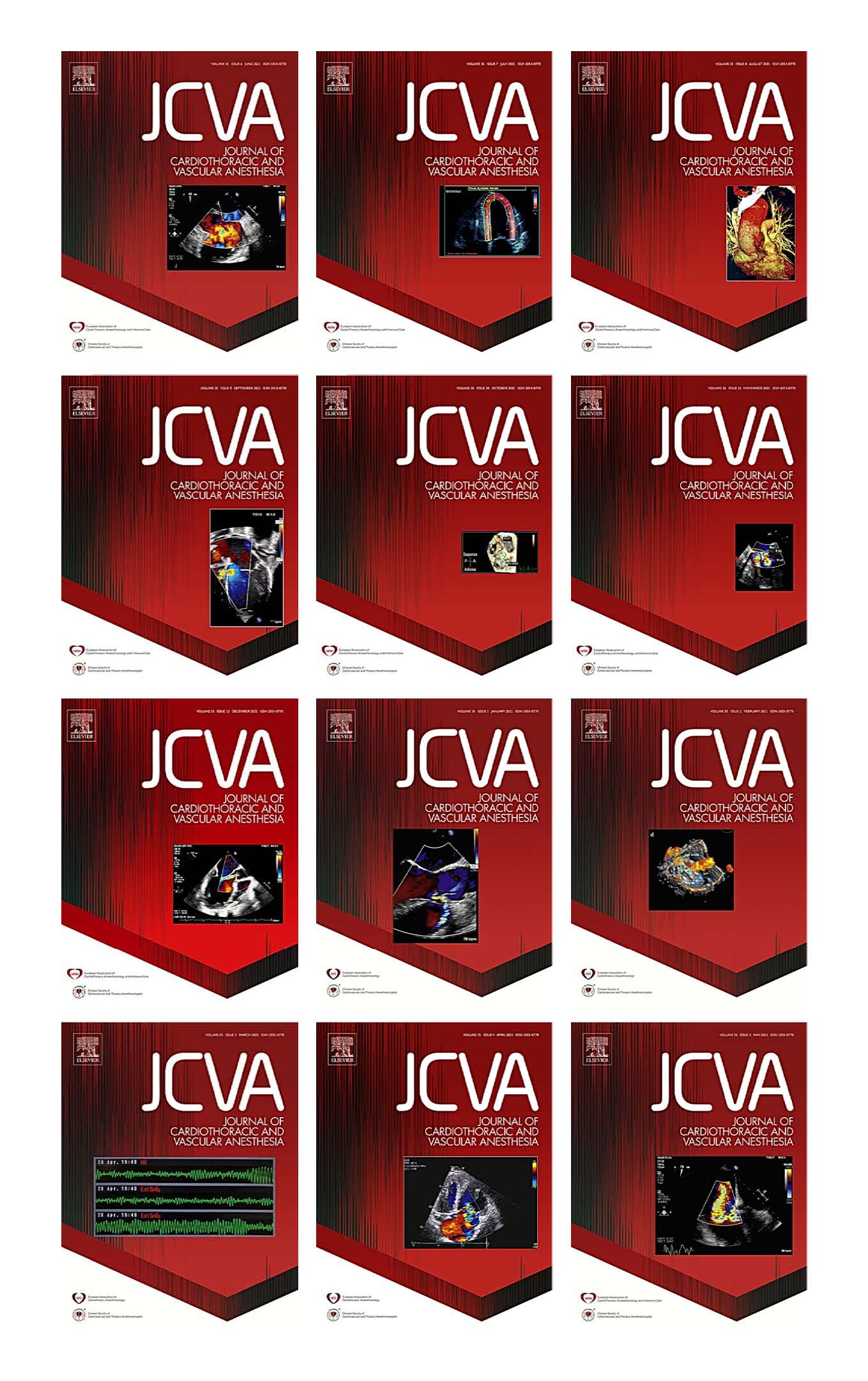 Journal of Cardiothoracic and Vascular Anesthesia 2021 Full Archives