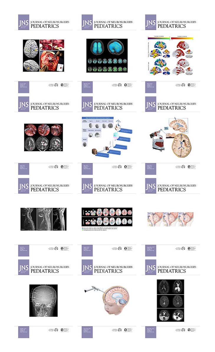Journal of Neurosurgery: Pediatrics 2021 Full Archives (True PDF)
