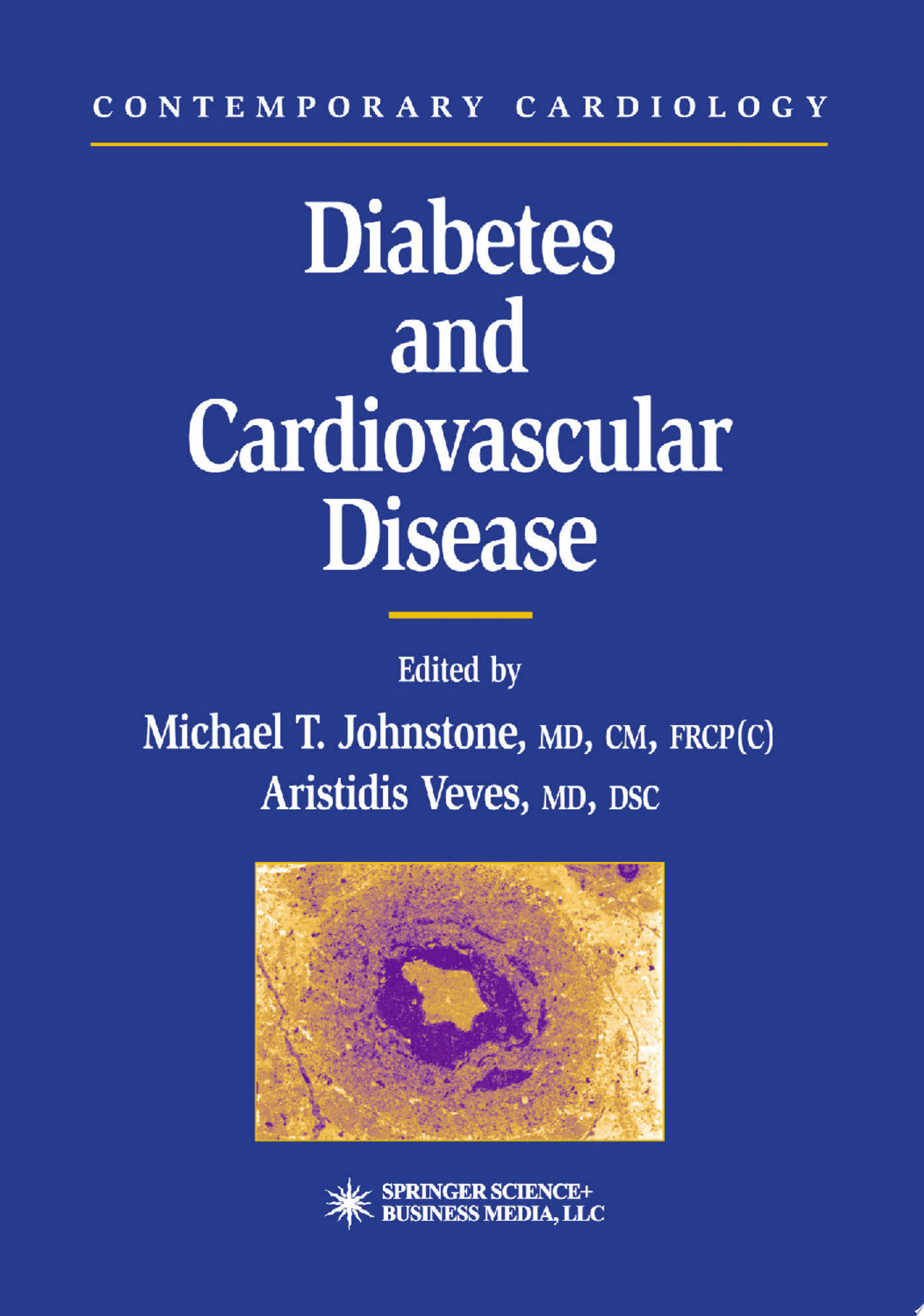 Diabetes and Cardiovascular Disease , 3rd Edition