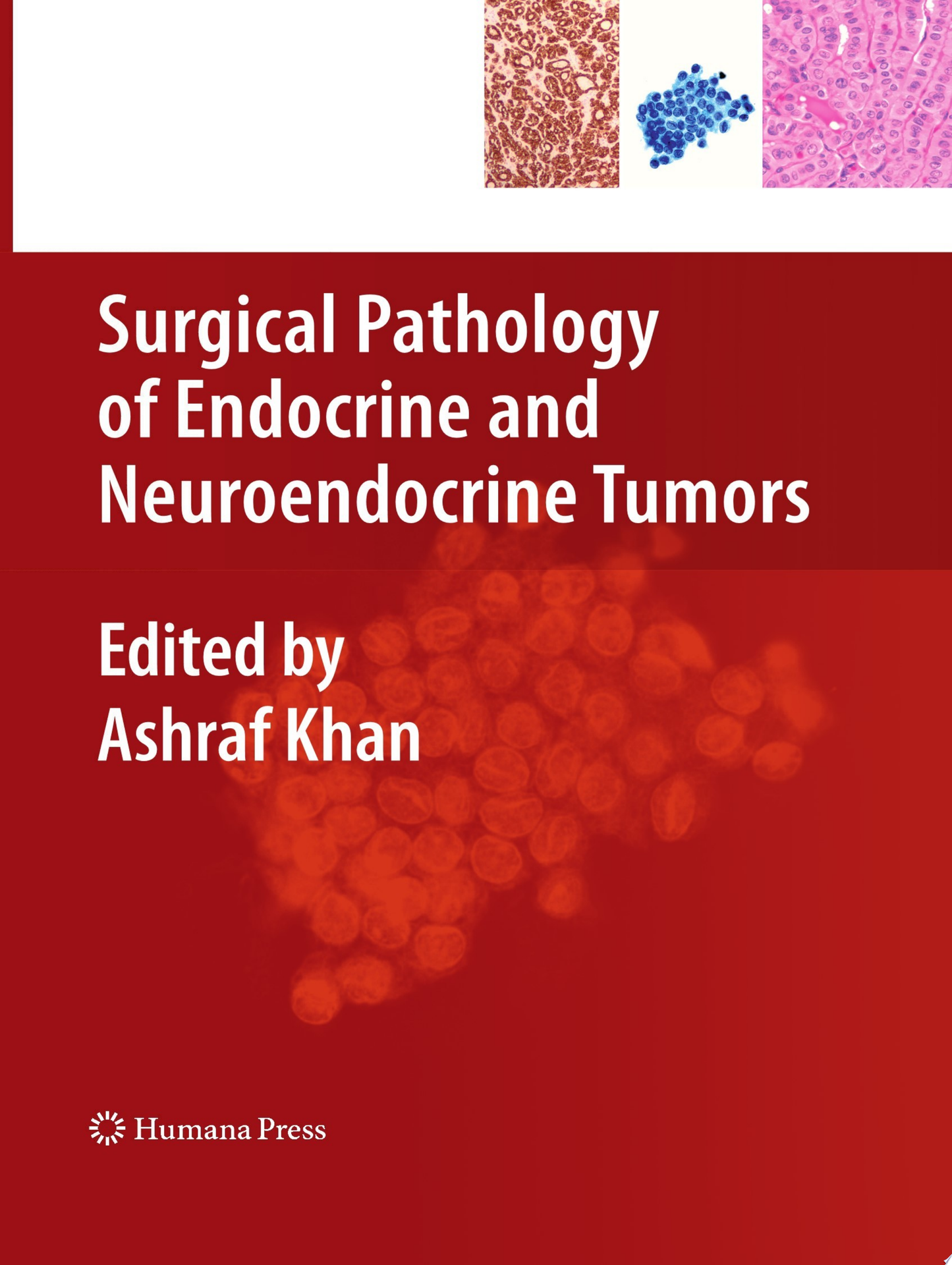Tumors of the Pituitary Gland