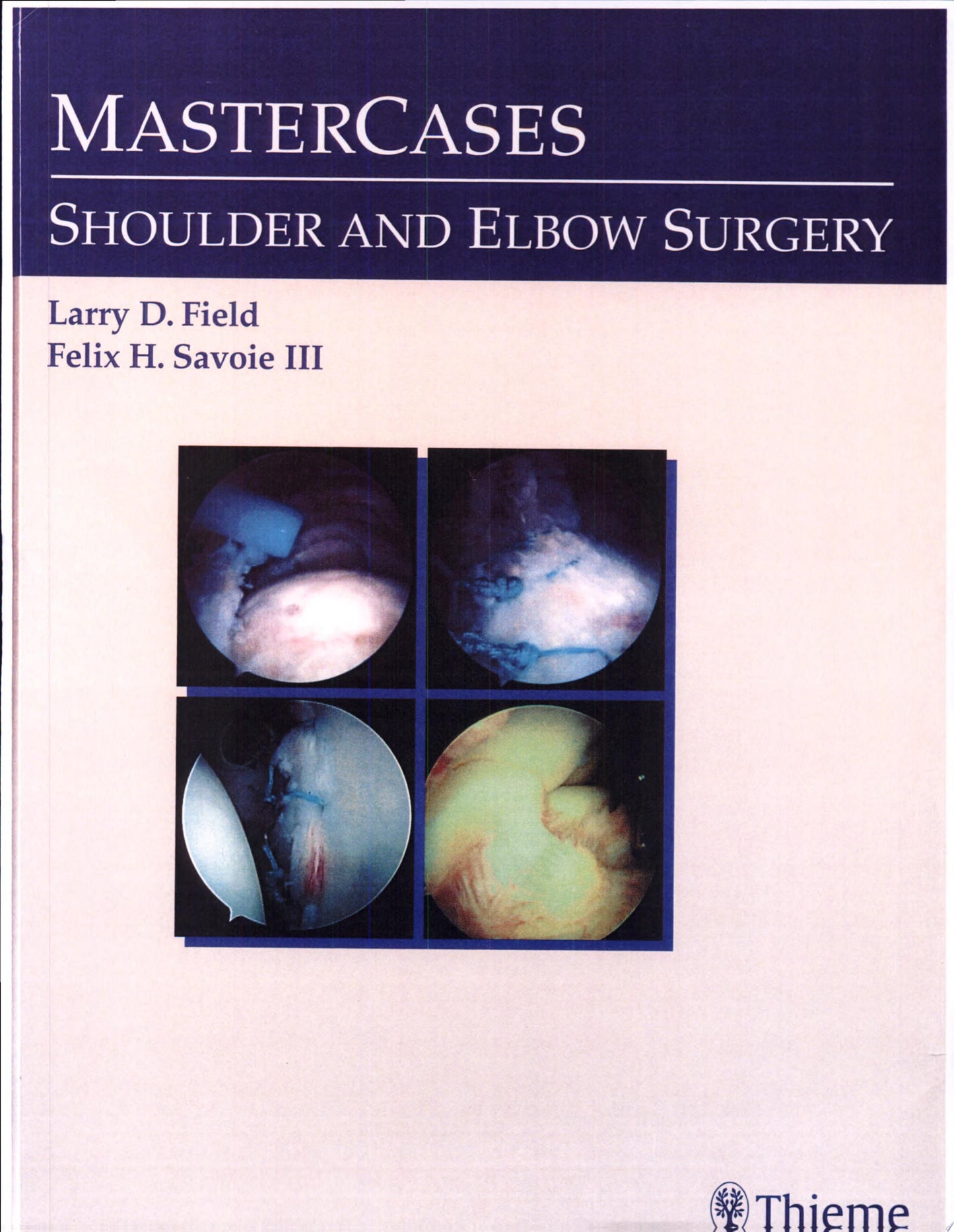 MasterCases: Shoulder and Elbow Surgery
